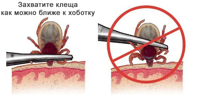 Как правильно удалить клеща с животного Как правильно удалить клеща с животного